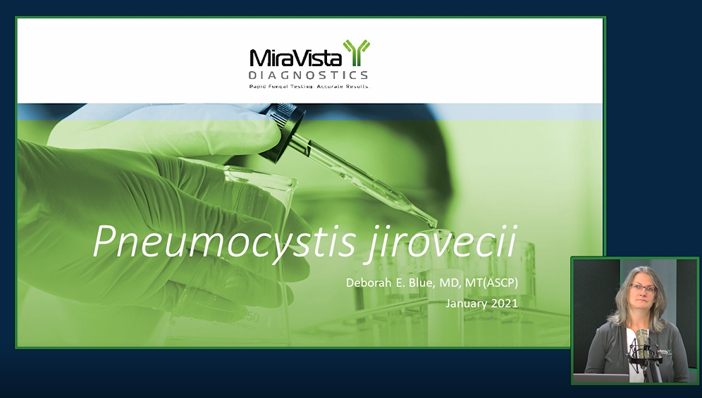 Pneumocystis Jirovecii: Risks, Symptoms And Laboratory Diagnosis